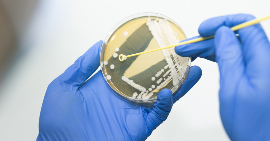 Sterility Testing