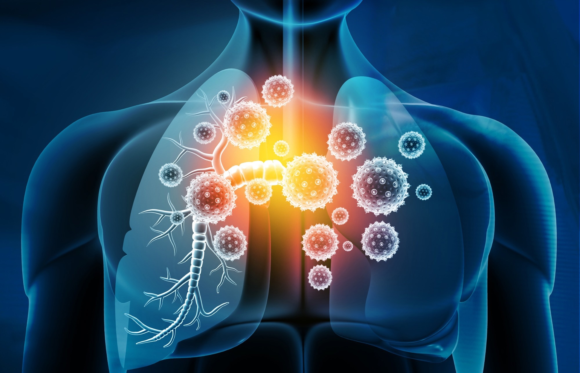 Respiratory Infectious Diseases Respiratory Infectious Diseases